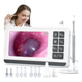 Otoscopio Profesional Digital 3.9mm Pantalla 4.3in Hd Oido Blanco