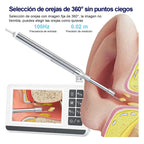 Otoscopio Profesional Digital 3.9mm Pantalla 4.3in Hd Oido Blanco