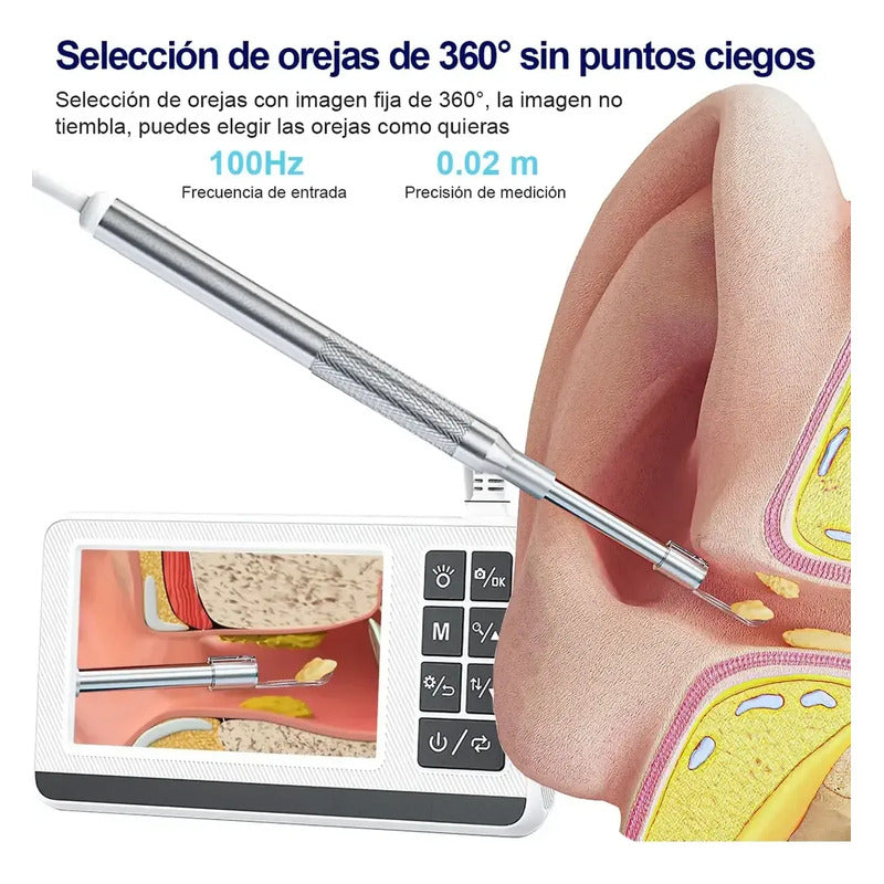 Otoscopio Profesional Digital 3.9mm Pantalla 4.3in Hd Oido Blanco