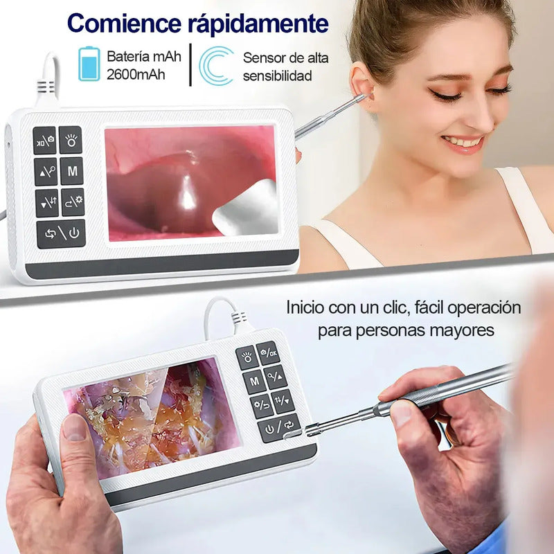 Otoscopio Profesional Digital 3.9mm Pantalla 4.3in Hd Oido Blanco